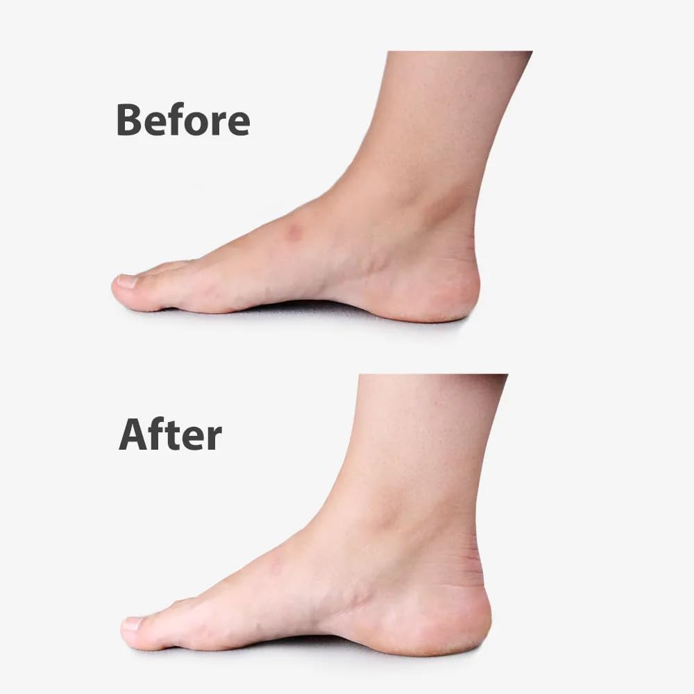 Scar Gone : améliorez la couleur et la texture de vos cicatrices pour une peau radieuse