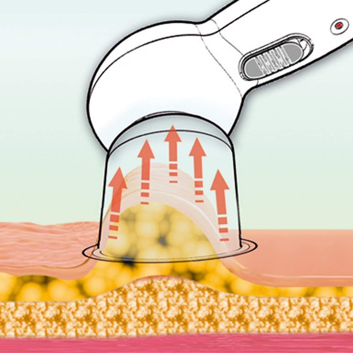 Masseur anti-cellulite électrique infrarouge : l'allié parfait pour un corps tonifié et raffermi Pour les femmes soucieuses de leur silhouette, cet appareil de massage sous vide USB transforme votre routine de soin en un moment de bien-être exceptionnel. – Image 8