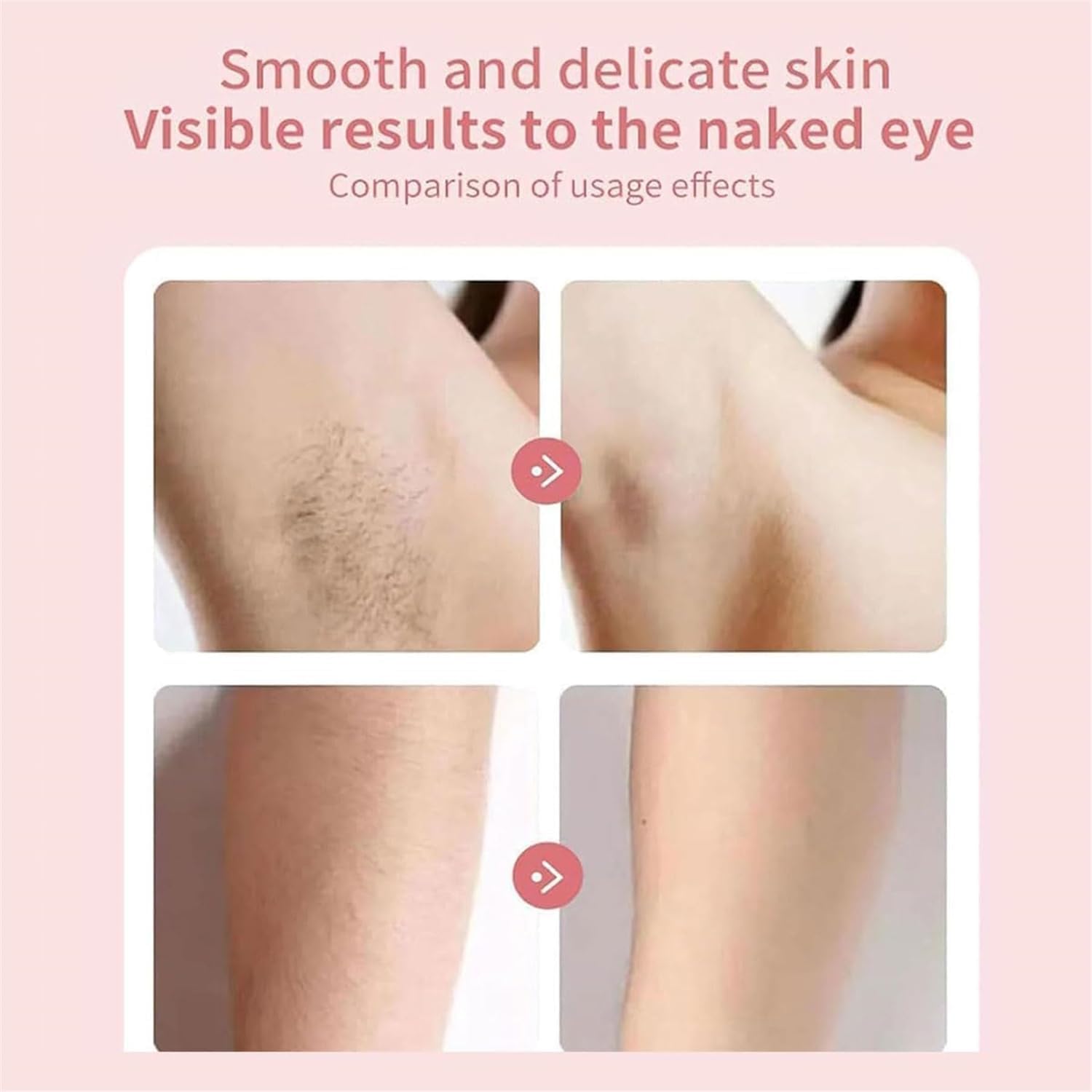 Épilateur de visage 2 en 1 pour femme : une solution instantanée et indolore pour un épilateur polyvalent – Image 6