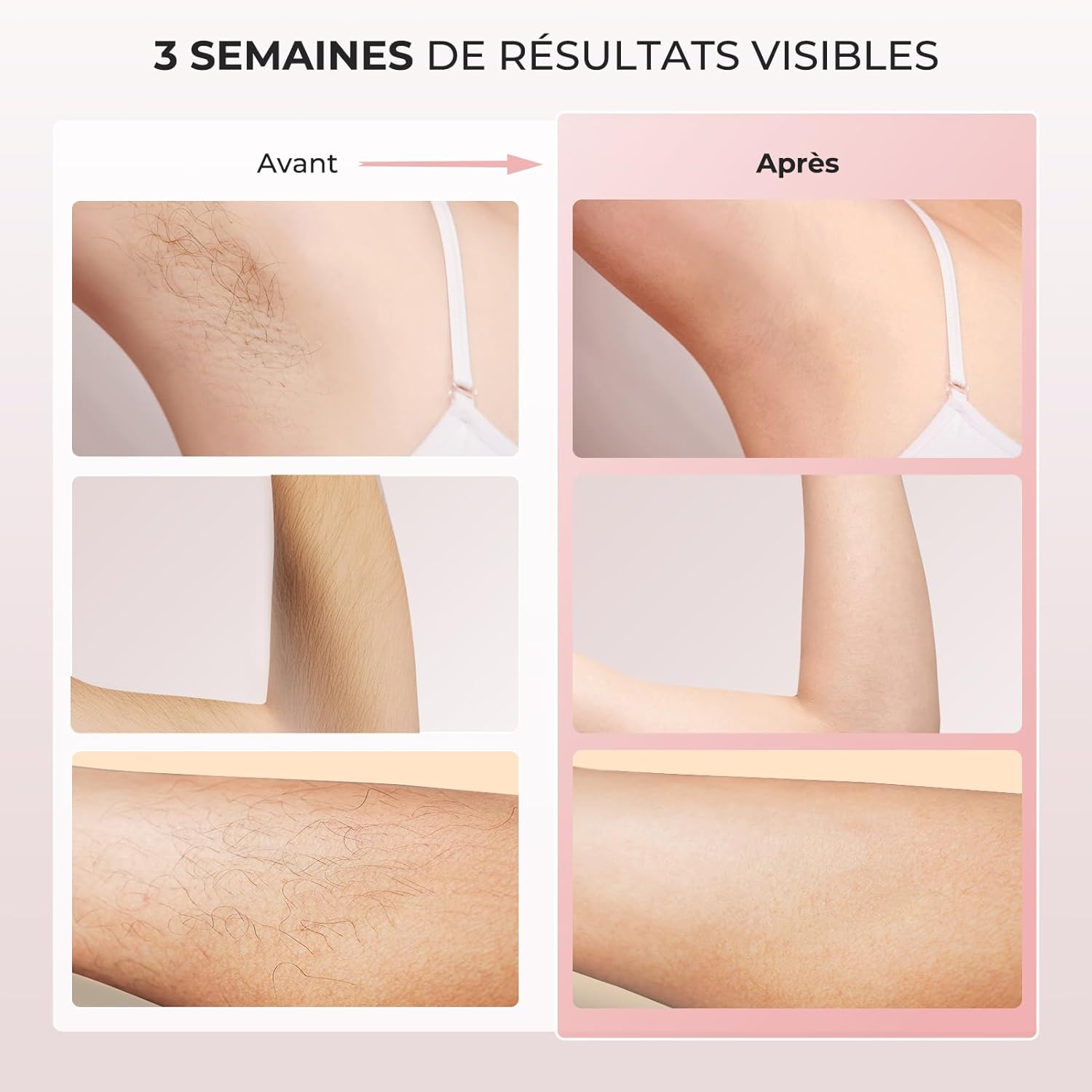 Épilateur lumière pulsée 3 en 1 : pour une épilation efficace et douce à domicile Profitez d'une peau lisse et soyeuse avec notre épilateur laser à écran tactile LCD, doté de 9 niveaux d'énergie et d'une fonction de refroidissement pour un confort optimal. – Image 6