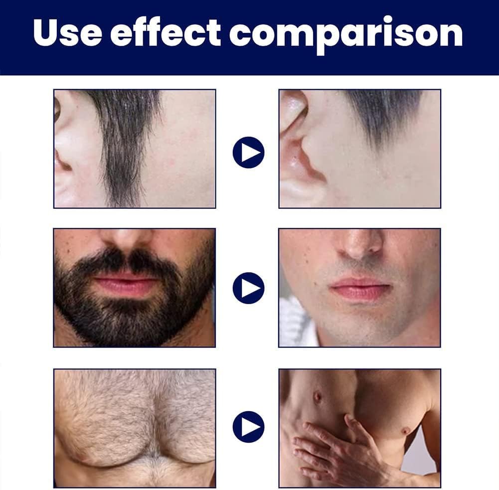 Crème d'épilation permanente pour homme : une solution efficace pour un visage doux et soyeux – Image 9