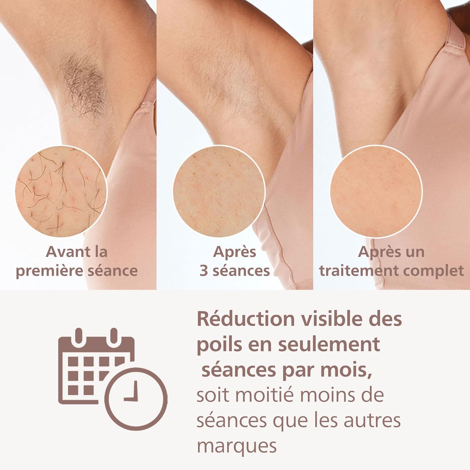 Épilateur à Lumière Pulsée Philips Lumea 8000 Technologie SenseIQ Pour Un Confort Optimal – Image 3