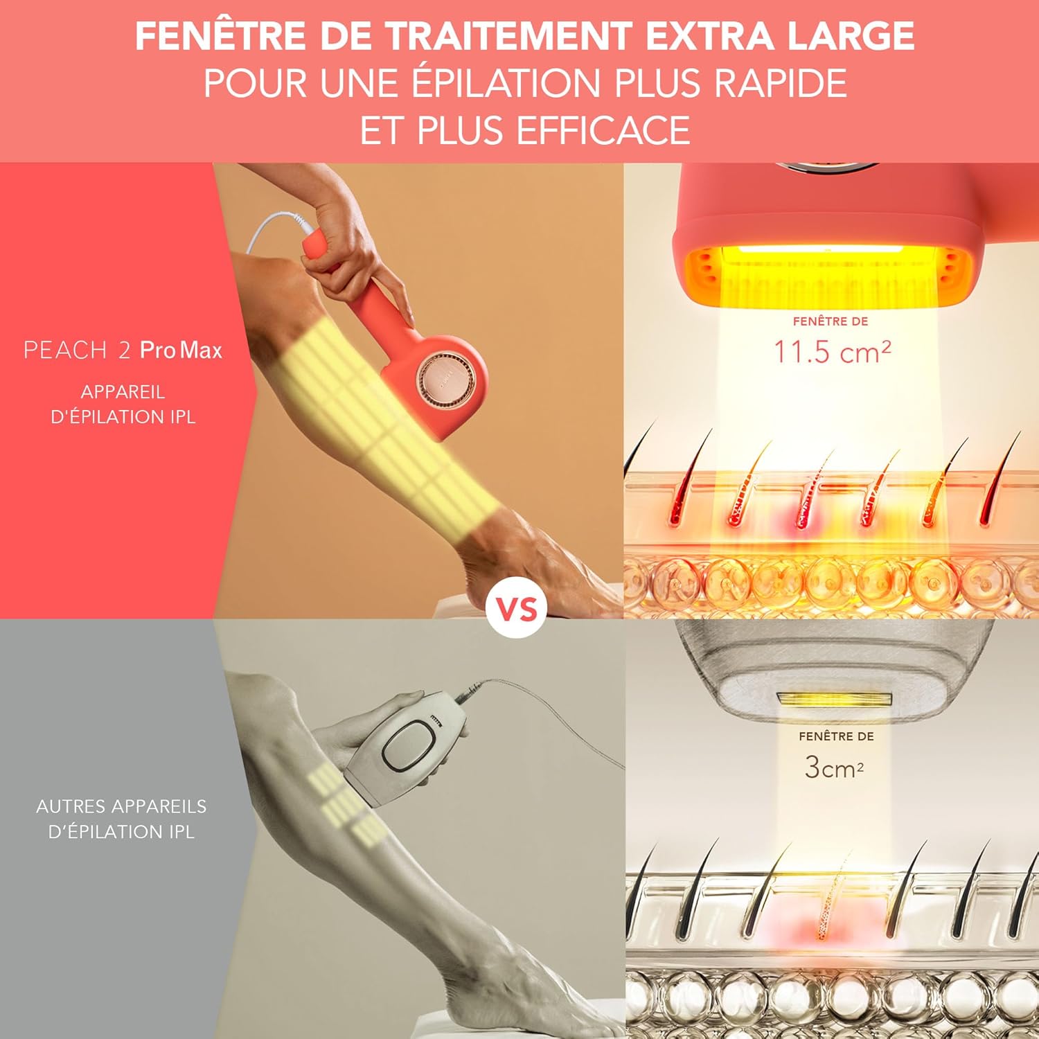 Épilation Permanente IPL : Peau Lisse à Domicile – Image 3