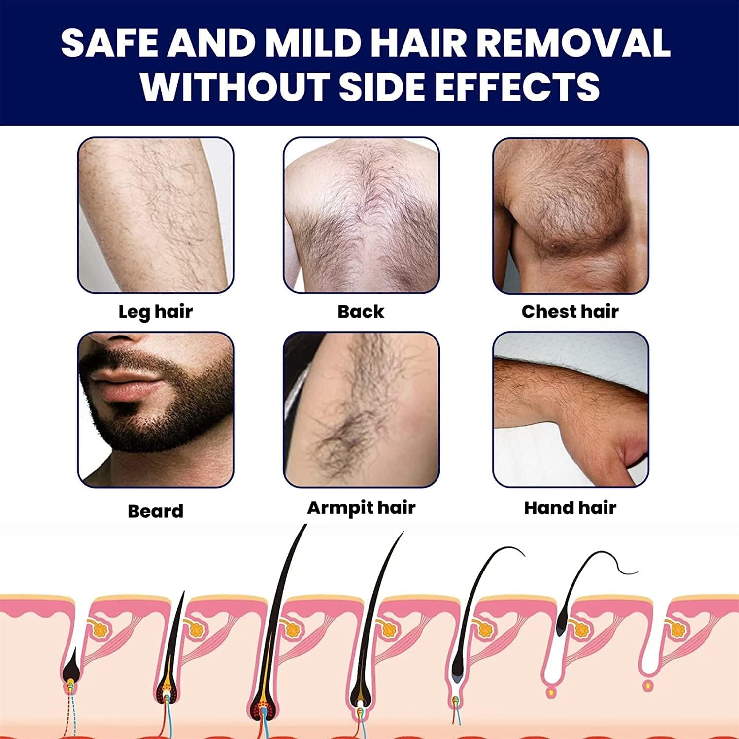Crème d'épilation permanente pour homme : une solution efficace pour un visage doux et soyeux – Image 7