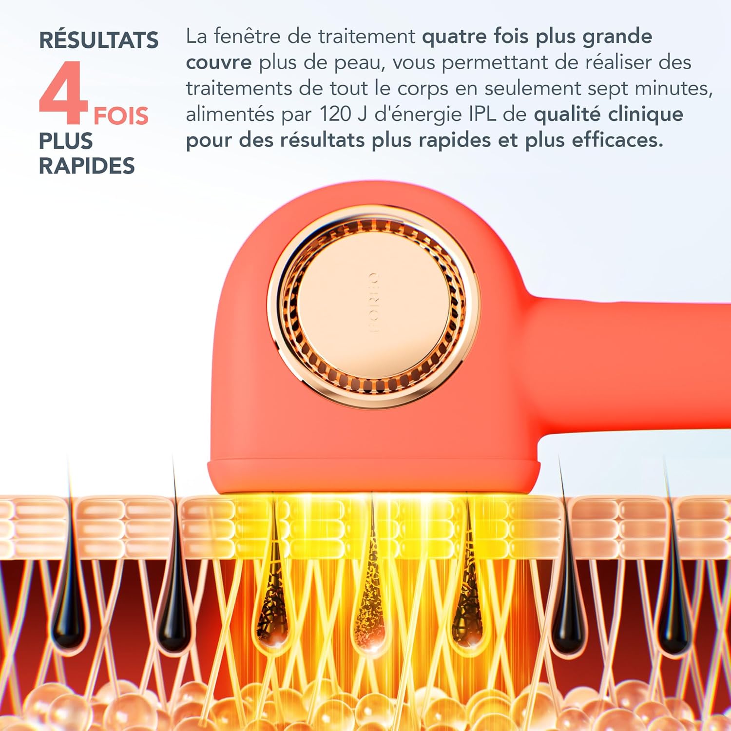 Épilation Permanente IPL : Peau Lisse à Domicile – Image 6