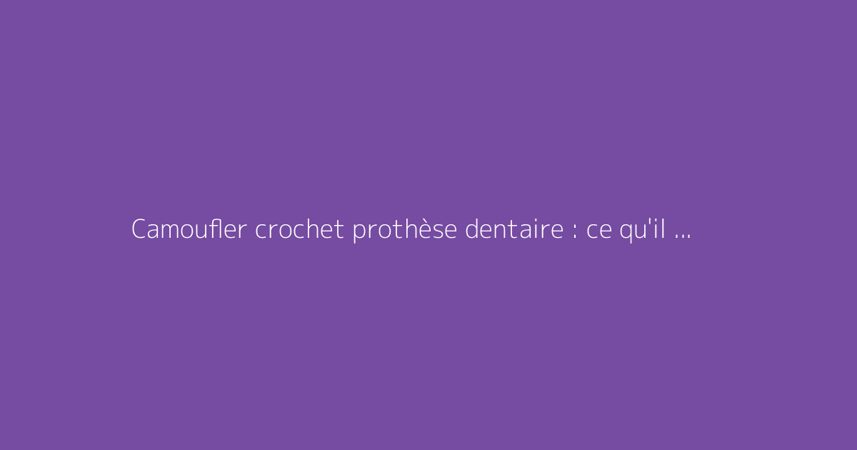 Camoufler crochet prothèse dentaire : ce qu'il faut vraiment savoir