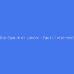 Capsulite épaule et cancer : faut-il vraiment s'inquiéter ?