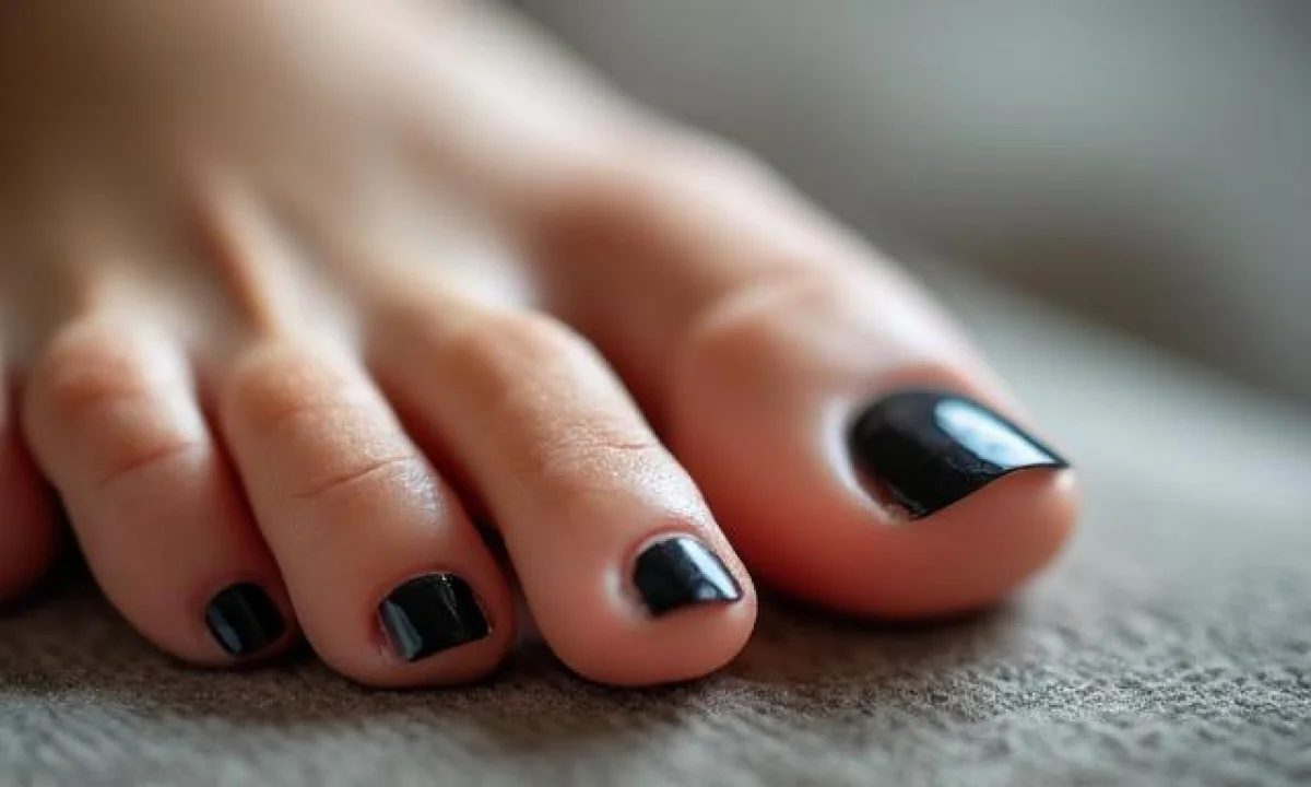 Ongle de pied noir sans choc : causes et traitement