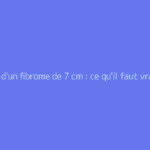 Poids d'un fibrome de 7 cm : ce qu'il faut vraiment savoir