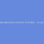 Prothese dentaire crochet invisible : ce qu'il faut vraiment savoir