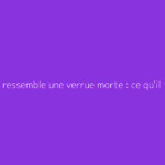 À quoi ressemble une verrue morte : ce qu'il faut vraiment savoir